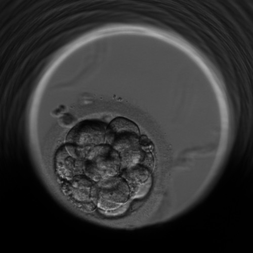 Exti Embryo HPAI